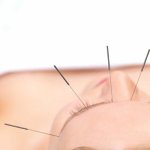 acupuntura-dra-tamara